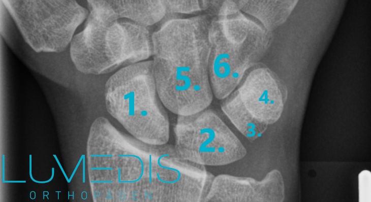 Röntgenbild der Handwurzel