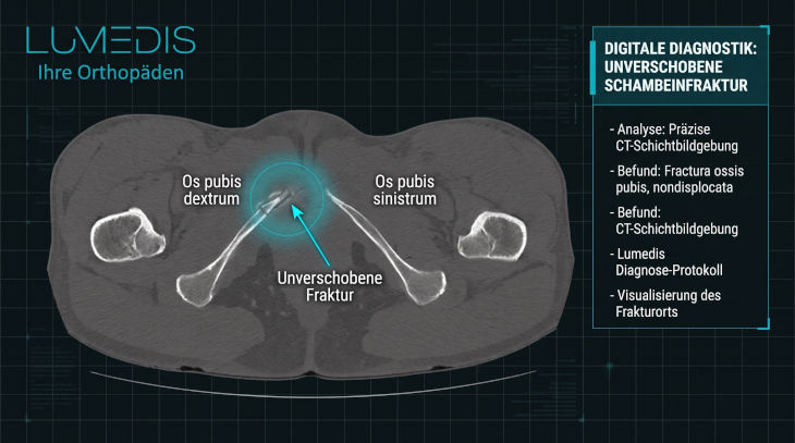 CT eines unverschobenen Schambeinbruchs