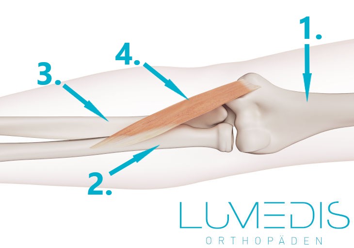 Abbildung des M. pronator teres Abbildung des M. pronator teres