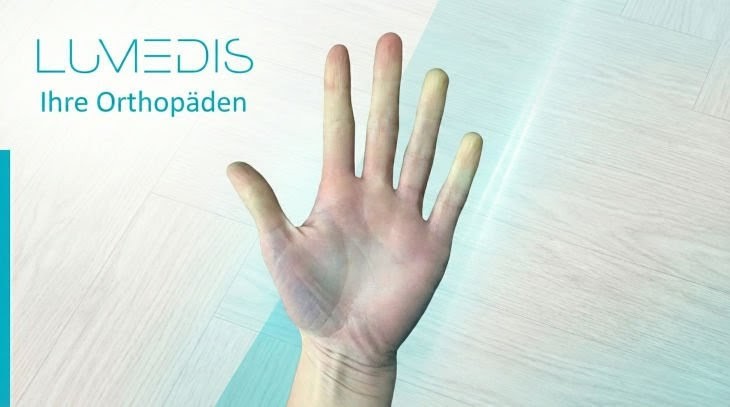 Morbus Raynaud in Start-Phase