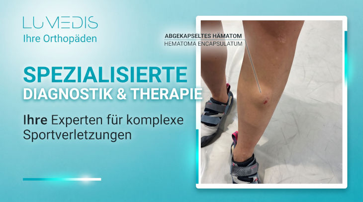 abgekapseltes Hämatom am Schienbein nach Prellung abgekapseltes Hämatom am Schienbein nach Prellung