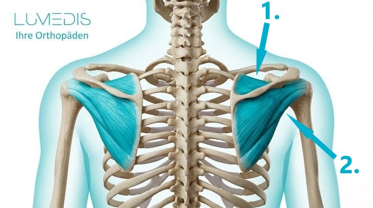 Musculus supraspinatus und infraspinatus mit Supraspinatussehne Musculus supraspinatus und infraspinatus mit Supraspinatussehne