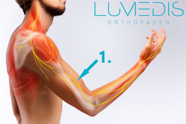 Verlauf des Nervus radialis von der HWS bis zur Hand