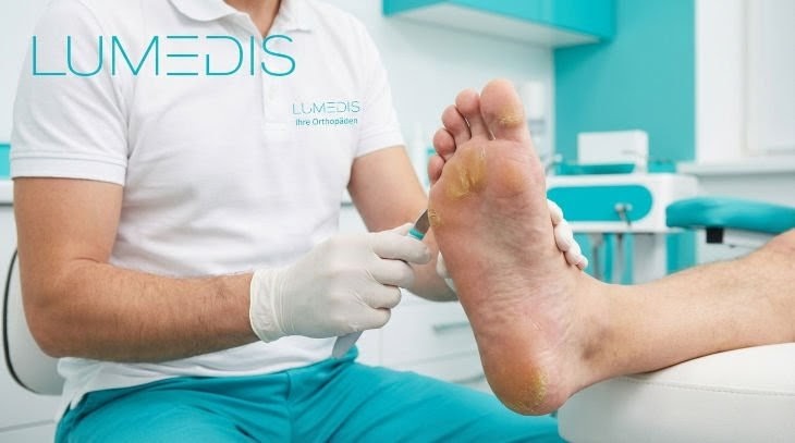 Schwielen am Fuß Schwielen am Fuß