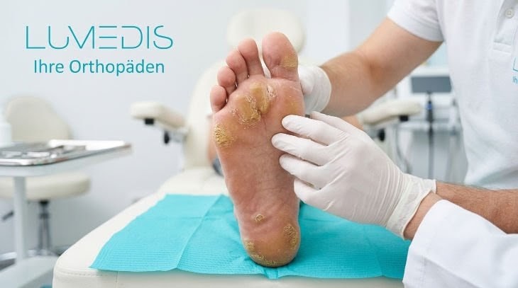 Schwielen unter Fuß