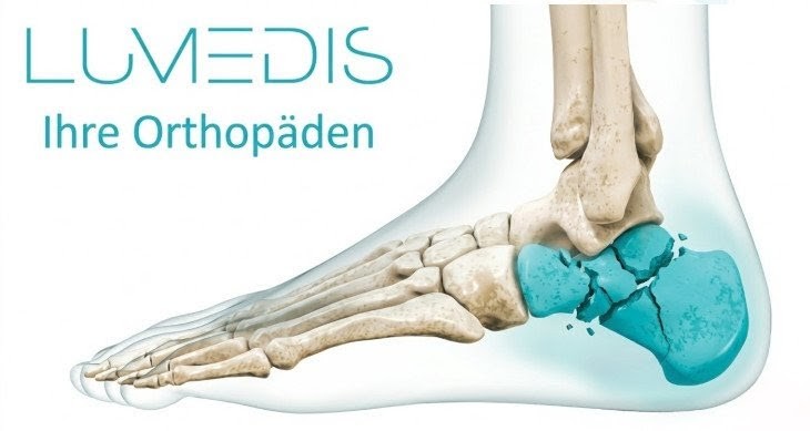 Abbildung eines Fersenbeinbruchs