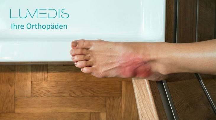 Bild einer MRT 5 Basis-Fraktur (Jones Fraktur)