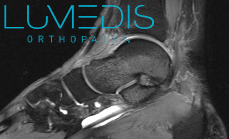 Entzündung der M. tibialis posterior Sehne Fuß im MRT