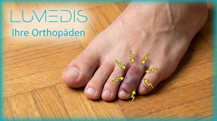 4. Zeh geprellt 4. Zeh geprellt