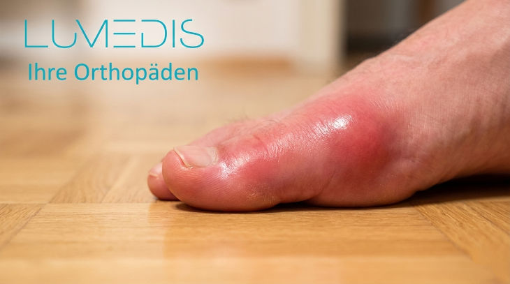 Gichtanfall im großen Zeh