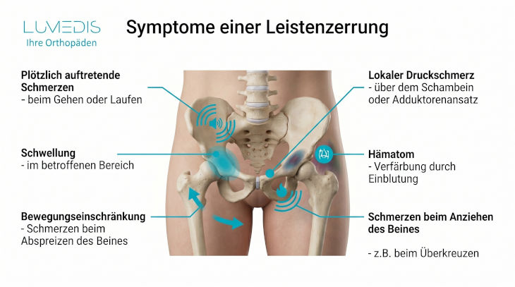 Abbildung: Symptome einer Leistenzerrung Abbildung: Symptome einer Leistenzerrung
