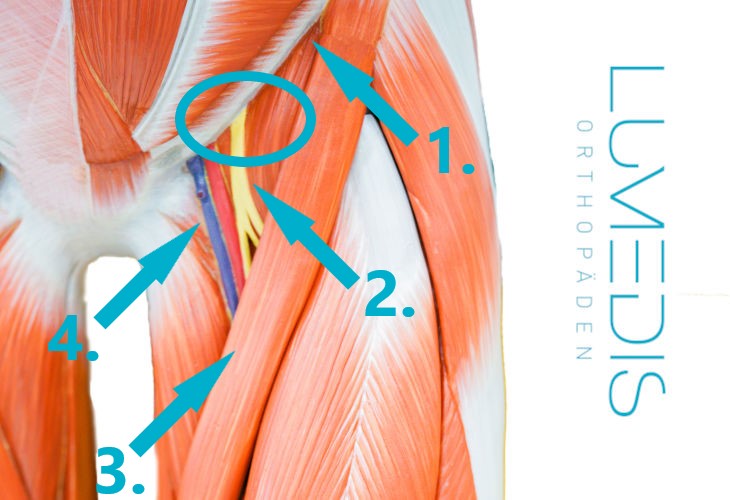 Meralgia paraesthetica