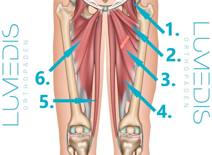 https://www.lumedis.de/fileadmin/Bilder/oberschenkel/Adduktoren/Muskelfaserriss_Adduktoren.jpeg