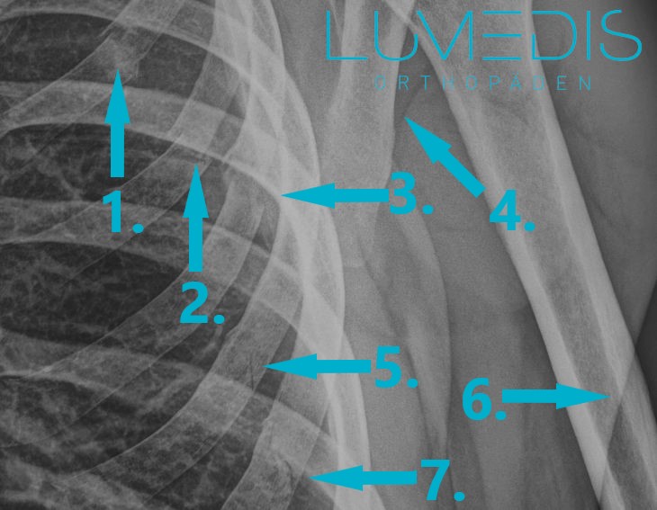 Lange rippenprellung wie Rippenprellung: Symptome,