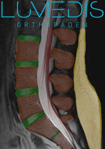 MRT der LWS - gesunde Bandscheibe