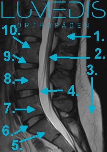 MRT der LWS - gesunde Bandscheibe