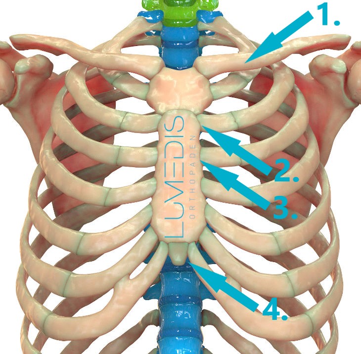 Tietze Syndrom