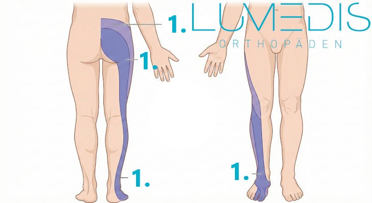 Dermatom L5 Dermatom L5