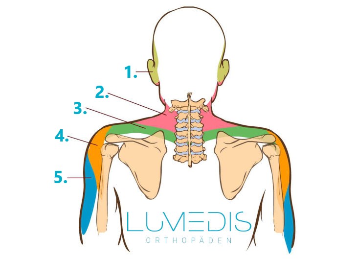 Dermatome von Arm und Hals