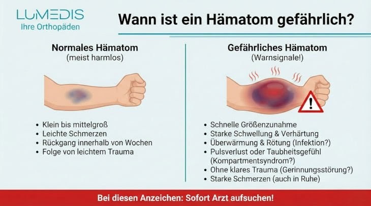 Wann ist ein Hämatom gefährlich?