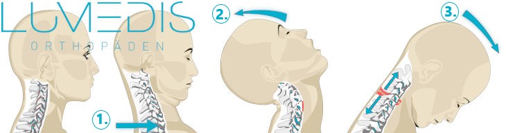 Schleudertrauma der HWS