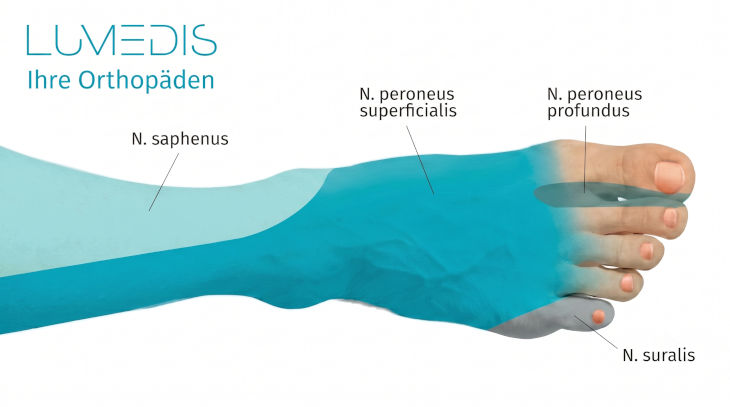Nervus peroneus am Fuß Nervus peroneus am Fuß